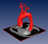 QuantVessel Bundestag